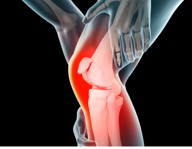 ایا واریس باعث زانو درد میشود