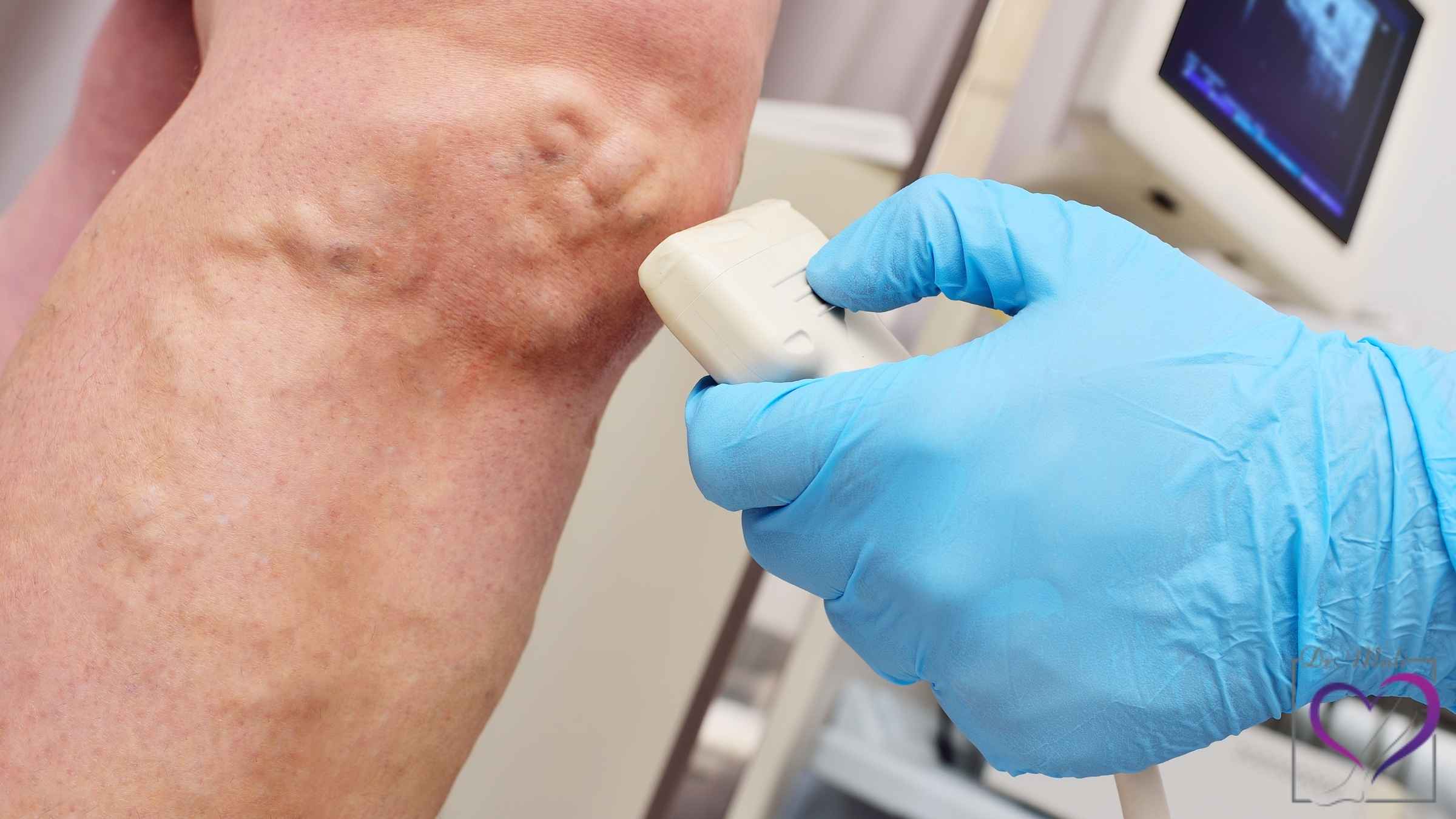 عمل واریس در یزد