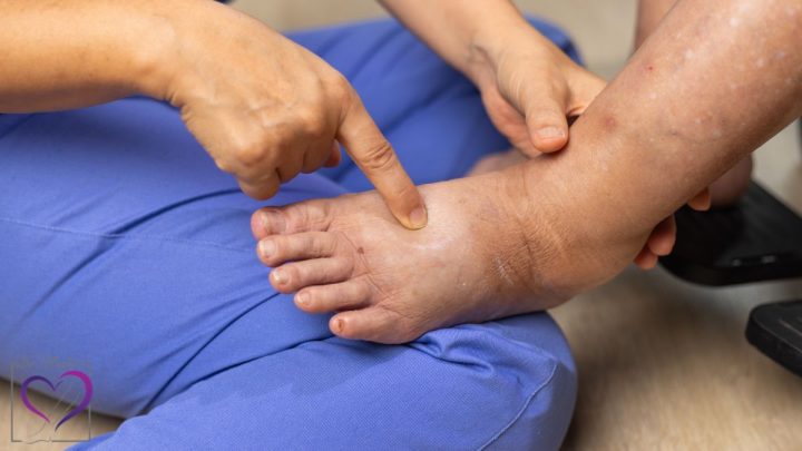 ورم روی پا از چیست؟ (5 دلیل اصلی)