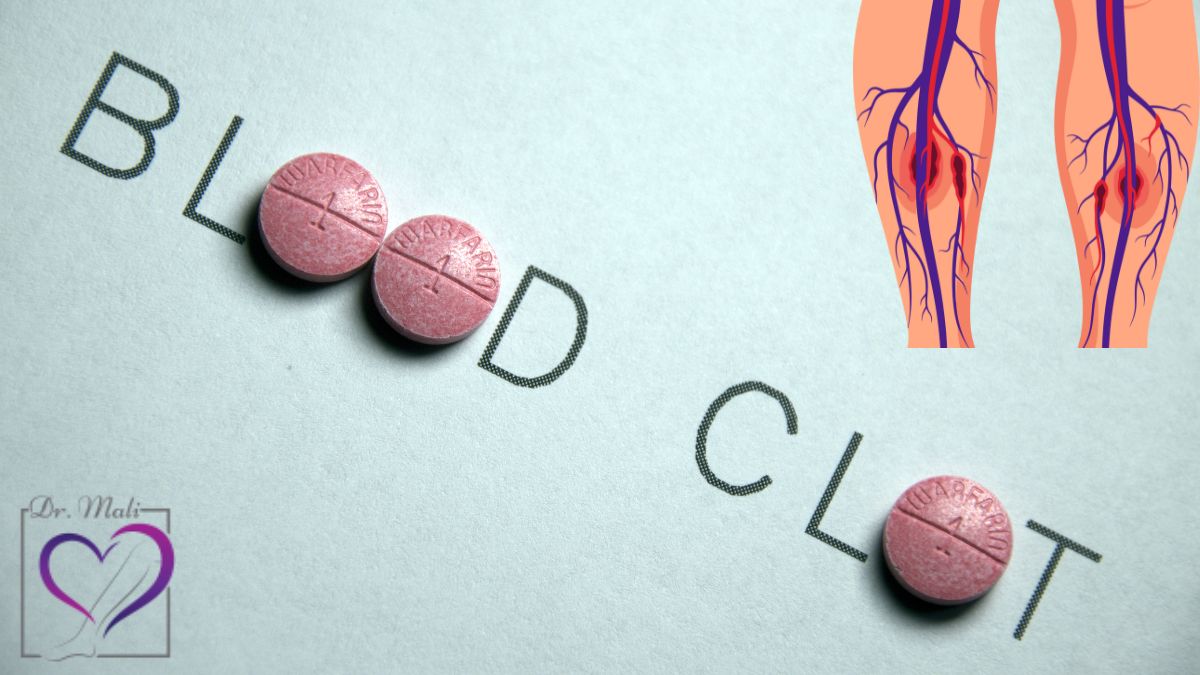 علائم هشداردهنده لخته شدن خون در پا